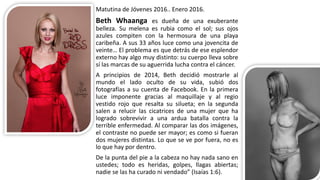 Matutina de Jóvenes 2016.. Enero 2016.
Beth Whaanga es dueña de una exuberante
belleza. Su melena es rubia como el sol; sus ojos
azules compiten con la hermosura de una playa
caribeña. A sus 33 años luce como una jovencita de
veinte… El problema es que detrás de ese esplendor
externo hay algo muy distinto: su cuerpo lleva sobre
sí las marcas de su aguerrida lucha contra el cáncer.
A principios de 2014, Beth decidió mostrarle al
mundo el lado oculto de su vida, subió dos
fotografías a su cuenta de Facebook. En la primera
luce imponente gracias al maquillaje y al regio
vestido rojo que resalta su silueta; en la segunda
salen a relucir las cicatrices de una mujer que ha
logrado sobrevivir a una ardua batalla contra la
terrible enfermedad. Al comparar las dos imágenes,
el contraste no puede ser mayor; es como si fueran
dos mujeres distintas. Lo que se ve por fuera, no es
lo que hay por dentro.
De la punta del pie a la cabeza no hay nada sano en
ustedes; todo es heridas, golpes, llagas abiertas;
nadie se las ha curado ni vendado” (Isaías 1:6).
 