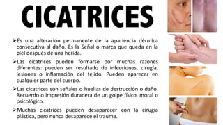CICATRICESØEs una alteración permanente de la apariencia dérmica
consecutiva al daño. Es la Señal o marca que queda en la
piel después de una herida.
ØLas cicatrices pueden formarse por muchas razones
diferentes: pueden ser resultado de infecciones, cirugía,
lesiones o inflamación del tejido. Pueden aparecer en
cualquier parte del cuerpo.
ØLas cicatrices son señales o huellas de destrucción o daño.
Recuerdo o impresión duradera de un golpe físico, moral o
psicológico.
ØMuchas cicatrices pueden desaparecer con la cirugía
plástica, pero nunca desaparece el trauma.
 