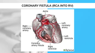 Cardiology 1.6. Heart Sounds and Murmurs - by Dr. Farjad Ikram | PPTX