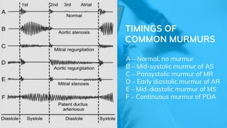 Cardiology 1.6. Heart Sounds and Murmurs - by Dr. Farjad Ikram | PPT