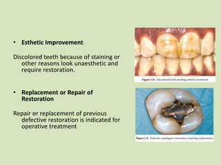 • Esthetic Improvement
Discolored teeth because of staining or
other reasons look unaesthetic and
require restoration.
• Replacement or Repair of
Restoration
Repair or replacement of previous
defective restoration is indicated for
operative treatment
 