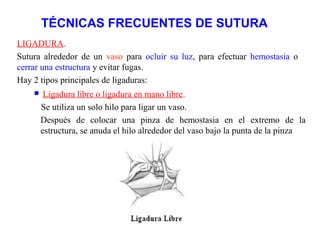 TÉCNICAS FRECUENTES DE SUTURA
LIGADURA.
Sutura alrededor de un vaso para ocluir su luz, para efectuar hemostasia o
cerrar una estructura y evitar fugas.
Hay 2 tipos principales de ligaduras:
 Ligadura libre o ligadura en mano libre.
Se utiliza un solo hilo para ligar un vaso.
Después de colocar una pinza de hemostasia en el extremo de la
estructura, se anuda el hilo alrededor del vaso bajo la punta de la pinza
 