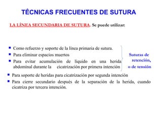 TÉCNICAS FRECUENTES DE SUTURA
 Como refuerzo y soporte de la línea primaria de sutura.
 Para eliminar espacios muertos
 Para evitar acumulación de líquido en una herida
abdominal durante la cicatrización por primera intención
LA LÍNEA SECUNDARIA DE SUTURA. Se puede utilizar:
 Para soporte de heridas para cicatrización por segunda intención
 Para cierre secundario después de la separación de la herida, cuando
cicatriza por tercera intención.
Suturas de
retención,
o de tensión
 