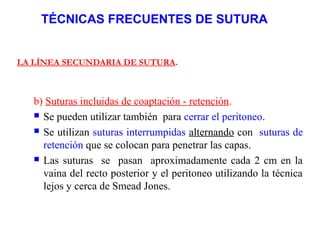 TÉCNICAS FRECUENTES DE SUTURA
LA LÍNEA SECUNDARIA DE SUTURA.
b) Suturas incluidas de coaptación - retención.
 Se pueden utilizar también para cerrar el peritoneo.
 Se utilizan suturas interrumpidas alternando con suturas de
retención que se colocan para penetrar las capas.
 Las suturas se pasan aproximadamente cada 2 cm en la
vaina del recto posterior y el peritoneo utilizando la técnica
lejos y cerca de Smead Jones.
 