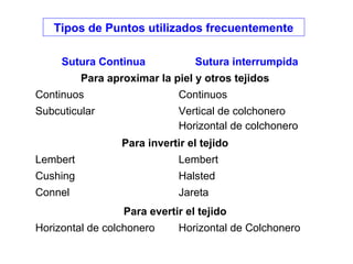 Sutura Continua Sutura interrumpida
Para aproximar la piel y otros tejidos
Continuos Continuos
Subcuticular Vertical de colchonero
Horizontal de colchonero
Para invertir el tejido
Lembert Lembert
Cushing Halsted
Connel Jareta
Para evertir el tejido
Horizontal de colchonero Horizontal de Colchonero
Tipos de Puntos utilizados frecuentemente
 