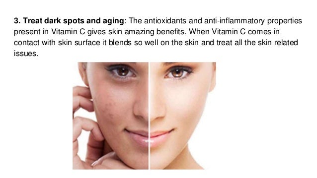 vitamin c moisturizer benefits