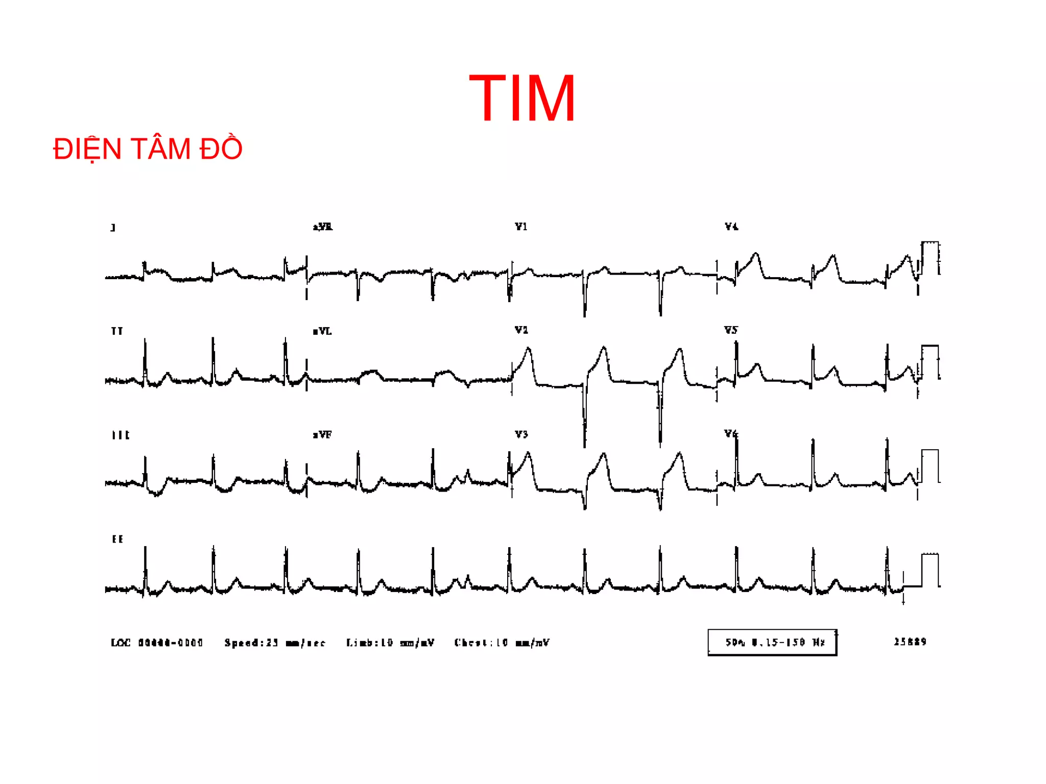 GIẢI PHẪU TIM | PDF
