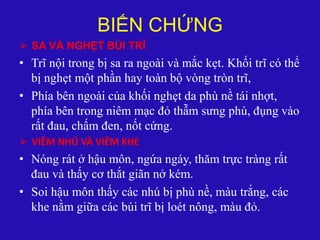 BIẾN CHỨNG
 SA VÀ NGHẸT BÚI TRĨ
• Trĩ nội trong bị sa ra ngoài và mắc kẹt. Khối trĩ có thể
bị nghẹt một phần hay toàn bộ vòng tròn trĩ,
• Phía bên ngoài của khối nghẹt da phù nề tái nhợt,
phía bên trong niêm mạc đỏ thẫm sưng phù, đụng vào
rất đau, chấm đen, nốt cứng.
 VIÊM NHÚ VÀ VIÊM KHE
• Nóng rát ở hậu môn, ngứa ngáy, thăm trực tràng rất
đau và thấy cơ thắt giãn nở kém.
• Soi hậu môn thấy các nhú bị phù nề, màu trắng, các
khe nằm giữa các búi trĩ bị loét nông, màu đỏ.
 
