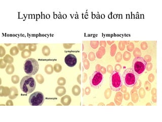 Lympho bào và tế bào đơn nhân
Monocyte, lymphocyte Large lymphocytes
 