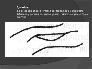 Ojal o Isla:
 Es el espacio elíptico formado por las ramas de una cresta
bifurcada y cerrada por convergencia. Pueden ser pequeñas o
grandes.
19
 