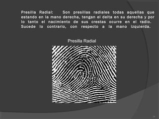 Presilla Radial: Son presillas radiales todas aquellas que
estando en la mano derecha, tengan el delta en su derecha y por
lo tanto el nacimiento de sus crestas ocurre en el radio.
Sucede lo contrario, con respecto a la mano izquierda.
 
Presilla Radial
29
 