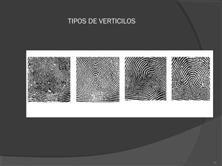 TIPOS DE VERTICILOS
32
 