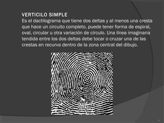 VERTICILO SIMPLE
Es el dactilograma que tiene dos deltas y al menos una cresta
que hace un circuito completo, puede tener forma de espiral,
oval, circular u otra variación de círculo. Una línea imaginaria
tendida entre los dos deltas debe tocar o cruzar una de las
crestas en recurva dentro de la zona central del dibujo.
33
 