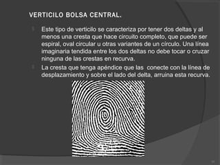 VERTICILO BOLSA CENTRAL.
 Este tipo de verticilo se caracteriza por tener dos deltas y al
menos una cresta que hace circuito completo, que puede ser
espiral, oval circular u otras variantes de un círculo. Una línea
imaginaria tendida entre los dos deltas no debe tocar o cruzar
ninguna de las crestas en recurva.
 La cresta que tenga apéndice que las conecte con la línea de
desplazamiento y sobre el lado del delta, arruina esta recurva.
35
 