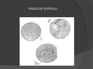 TRAZOS DE VERTICILO
40
 