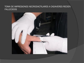 TOMA DE IMPRESIONES NECRODACTILARES A CADAVERES RECIEN
FALLECIDOS
 