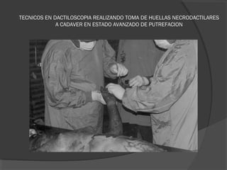 TECNICOS EN DACTILOSCOPIA REALIZANDO TOMA DE HUELLAS NECRODACTILARES
A CADAVER EN ESTADO AVANZADO DE PUTREFACION
 