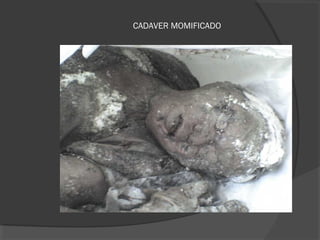 CADAVER MOMIFICADO
 