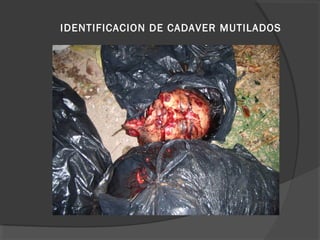IDENTIFICACION DE CADAVER MUTILADOS
 