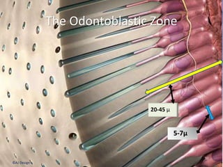 The Odontoblastic Zone
10
20-45 µ
5-7µ
©AJ Design
 