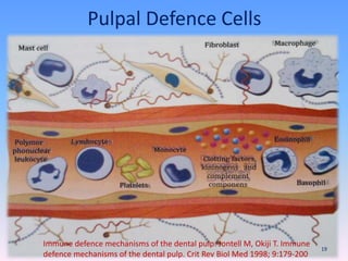 Pulpal Defence Cells
Immune defence mechanisms of the dental pulp. Jontell M, Okiji T. Immune
defence mechanisms of the dental pulp. Crit Rev Biol Med 1998; 9:179-200
19
 