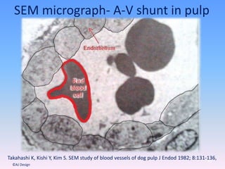 SEM micrograph- A-V shunt in pulp
43
©AJ Design
Takahashi K, Kishi Y, Kim S. SEM study of blood vessels of dog pulp J Endod 1982; 8:131-136,
 