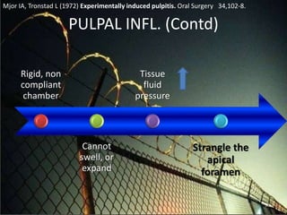 PULPAL INFL. (Contd)
Rigid, non
compliant
chamber
Cannot
swell, or
expand
Tissue
fluid
pressure
Strangle the
apical
foramen
59
Mjor IA, Tronstad L (1972) Experimentally induced pulpitis. Oral Surgery 34,102-8.
 