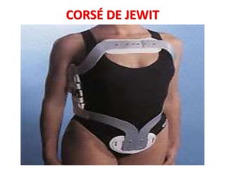 CORSÉ DE JEWIT
 