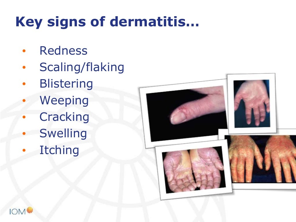 Why is dermal exposure important?