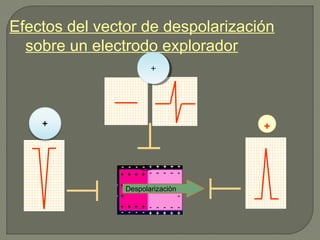 Efectos del vector de despolarización
sobre un electrodo explorador
Despolarizaciòn
+
++
 