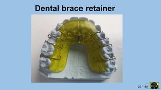 20 / 115
Dental brace retainer
 