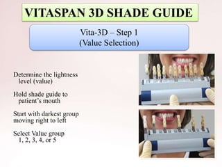 Vita-3D – Step 1
(Value Selection)
Determine the lightness
level (value)
Hold shade guide to
patient’s mouth
Start with darkest group
moving right to left
Select Value group
1, 2, 3, 4, or 5
VITASPAN 3D SHADE GUIDE
 