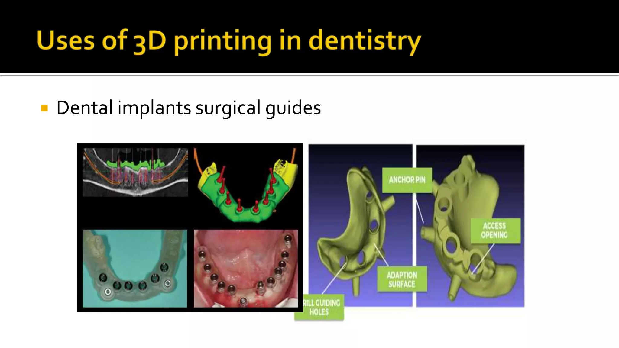 Advanced dental laboratory techniques :CAD/CAM & 3D printing | PPT