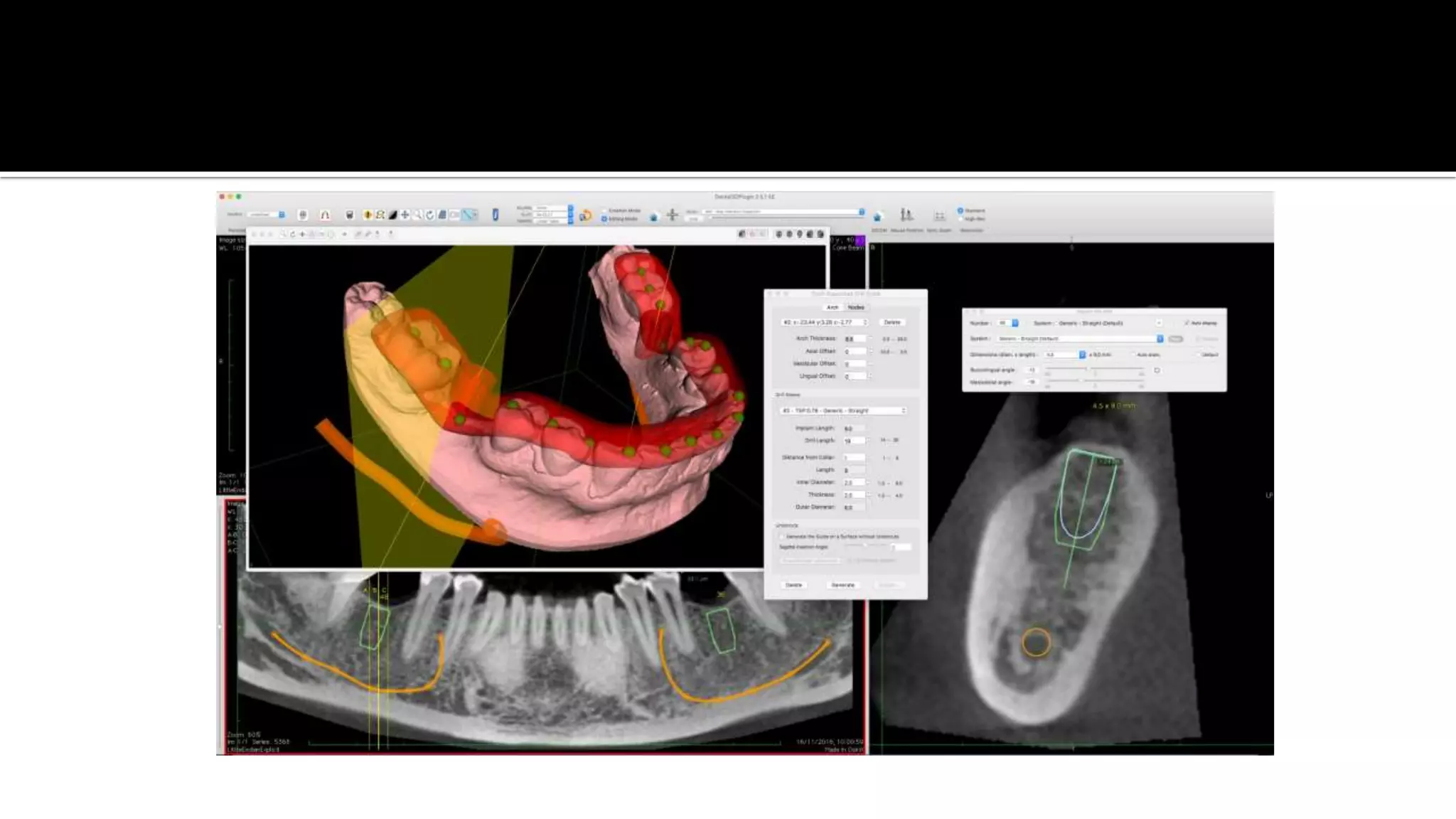 Advanced dental laboratory techniques :CAD/CAM & 3D printing | PPT