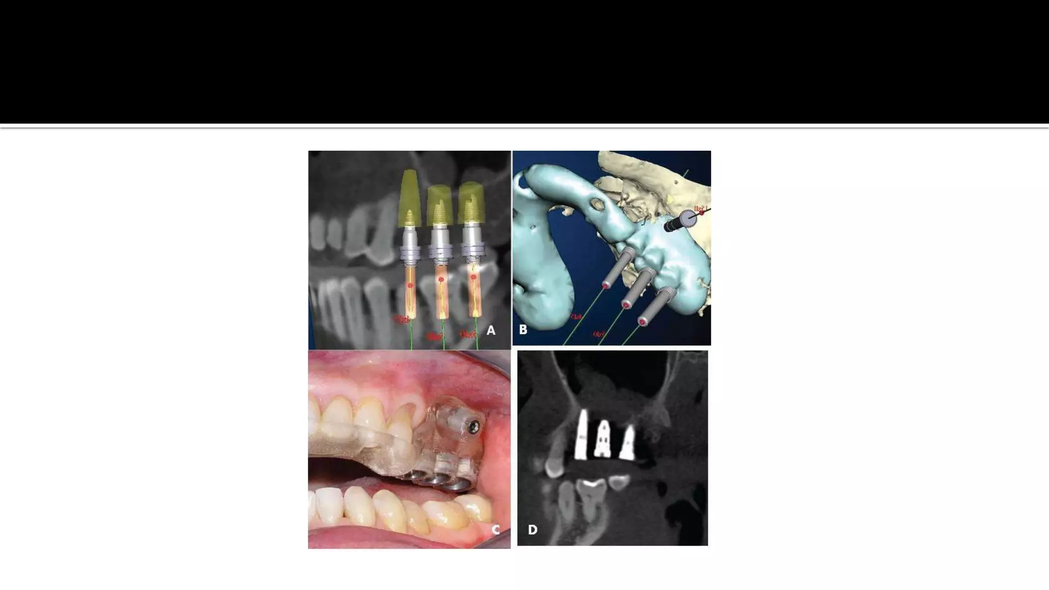 Advanced dental laboratory techniques :CAD/CAM & 3D printing | PPT