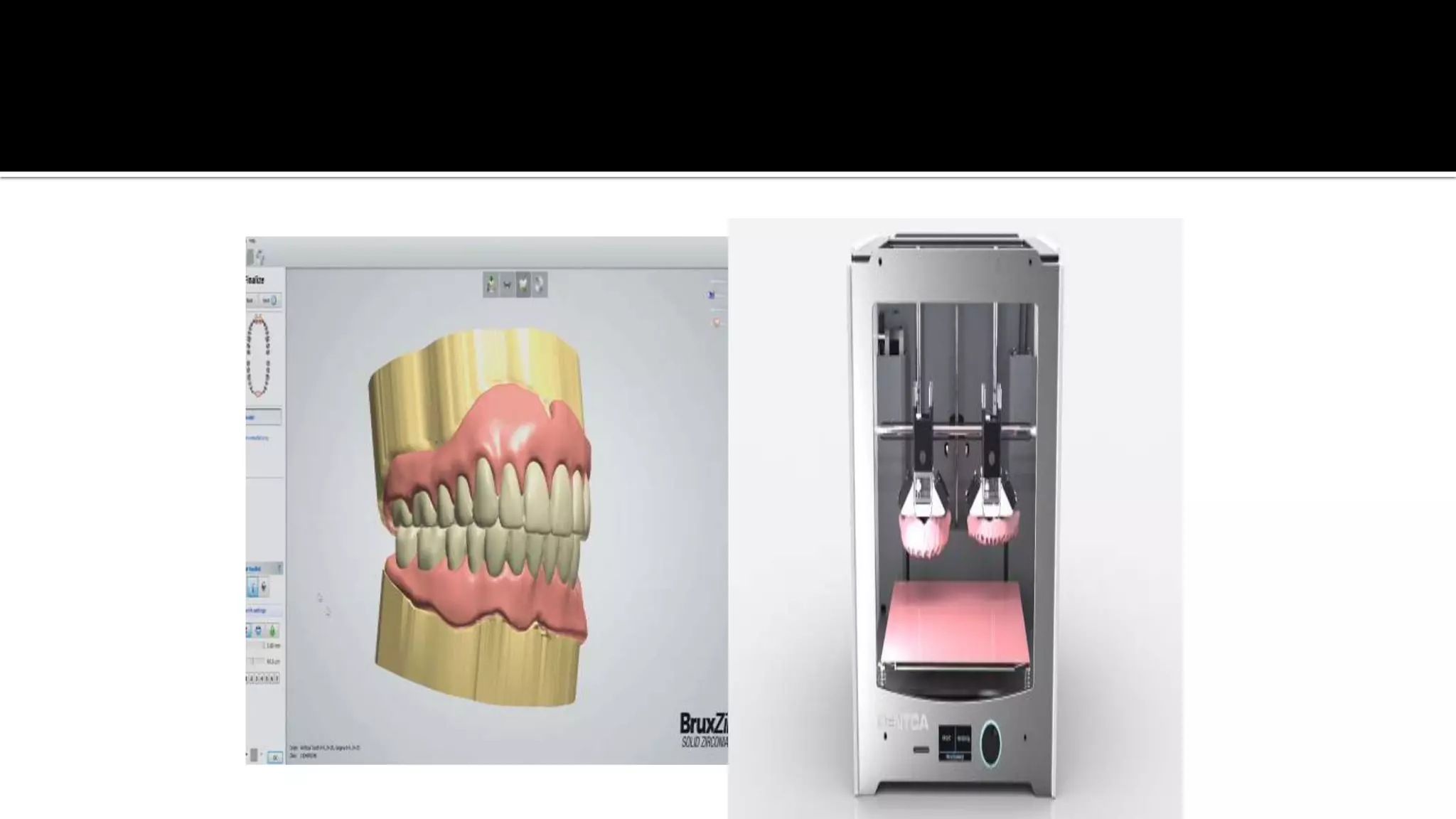 Advanced dental laboratory techniques :CAD/CAM & 3D printing | PPT