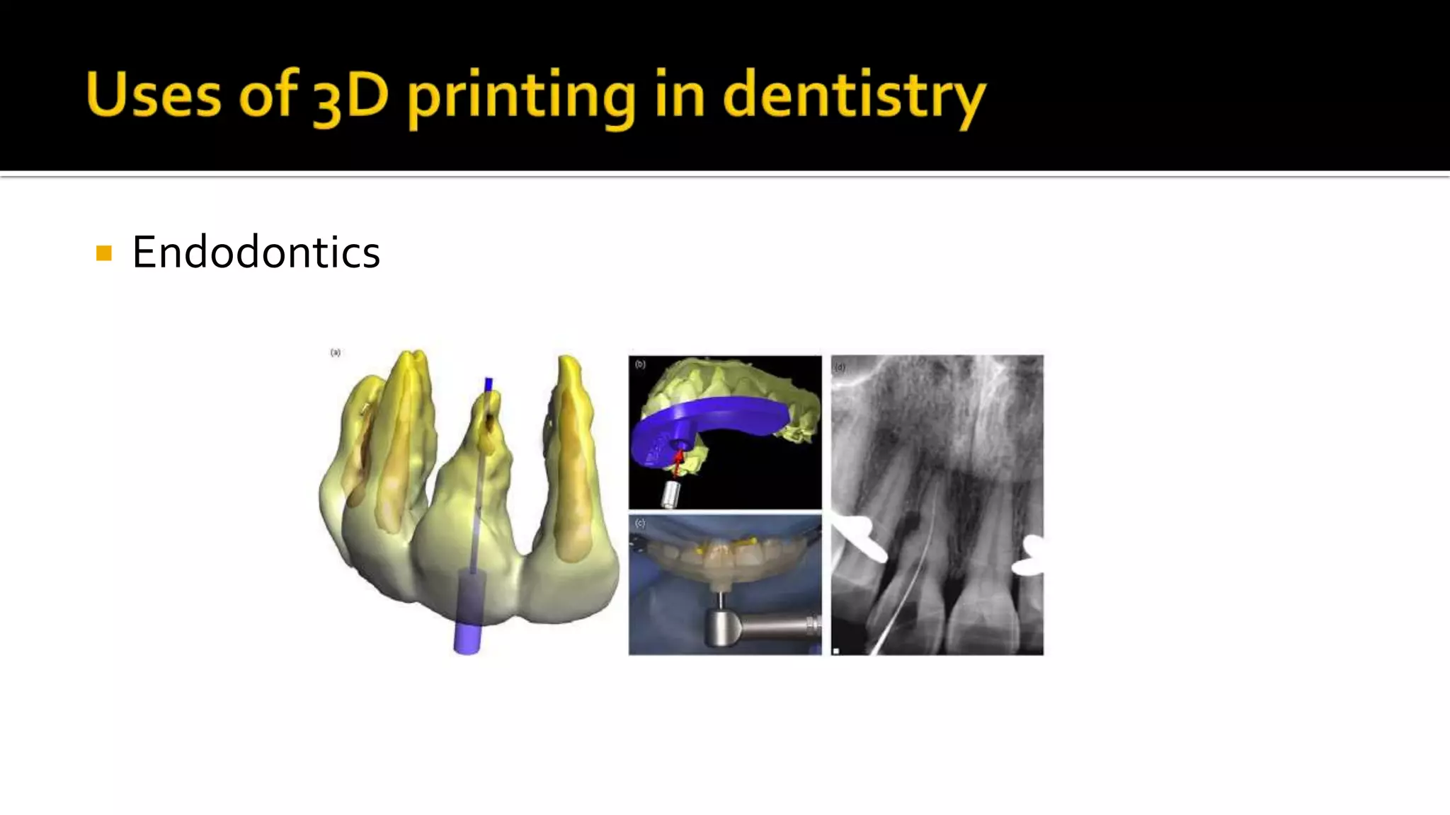 Advanced dental laboratory techniques :CAD/CAM & 3D printing | PPT