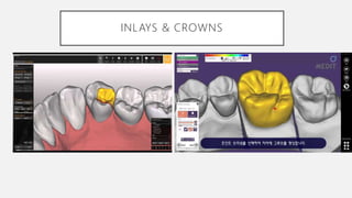 Advanced dental laboratory techniques :CAD/CAM & 3D printing | PPTX