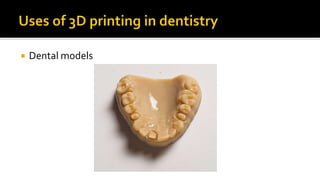 Advanced dental laboratory techniques :CAD/CAM & 3D printing | PPTX