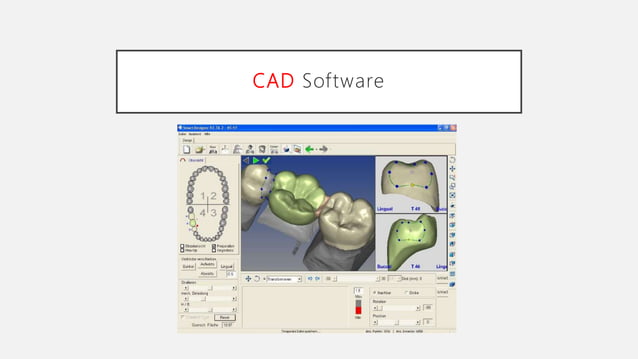 Advanced dental laboratory techniques :CAD/CAM & 3D printing | PPT