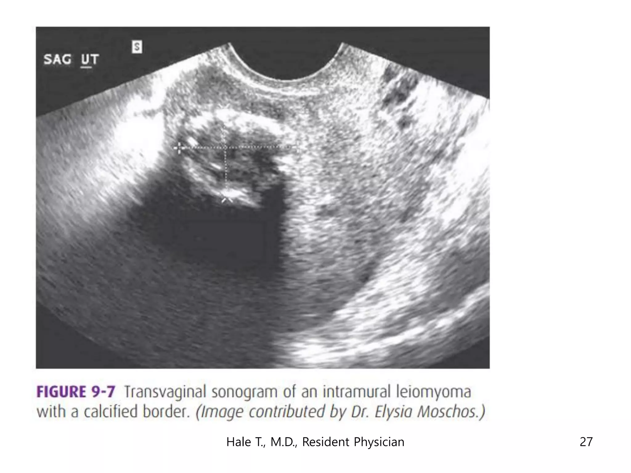 Hale T., M.D., Resident Physician 27
 