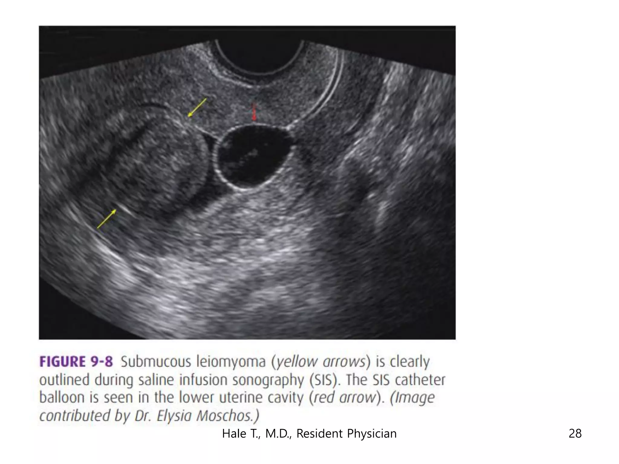 Hale T., M.D., Resident Physician 28
 
