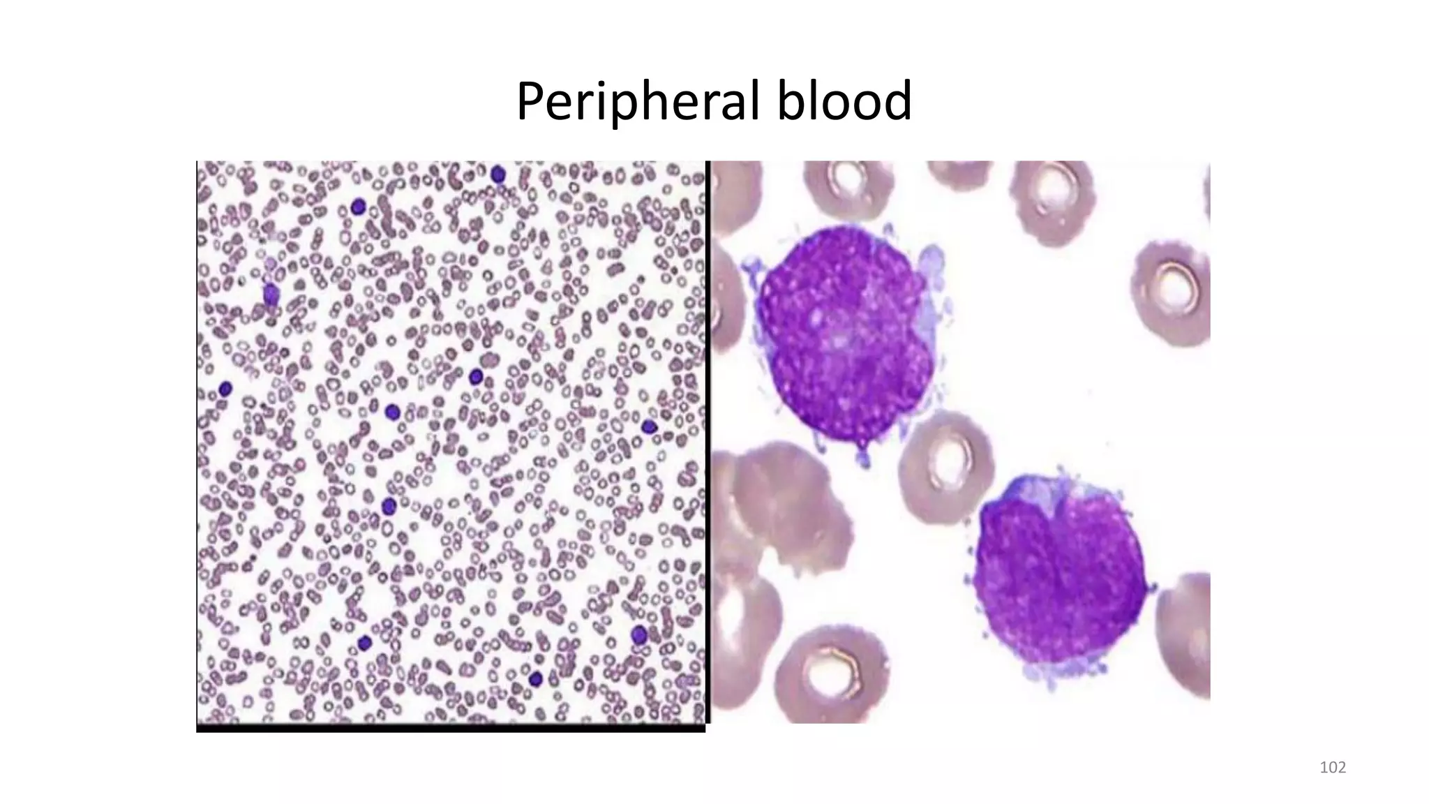 Peripheral blood
102
 