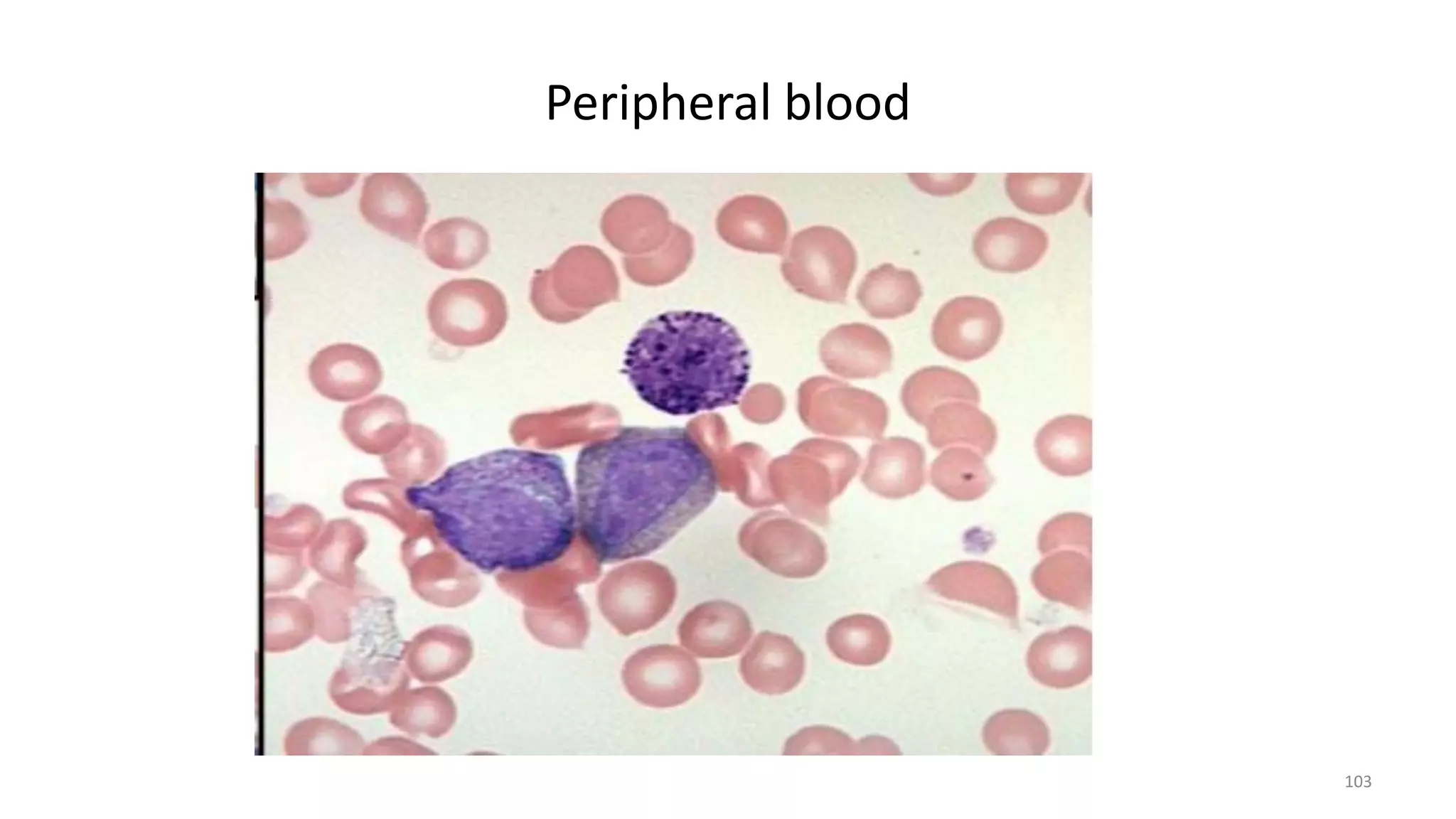 Peripheral blood
103
 