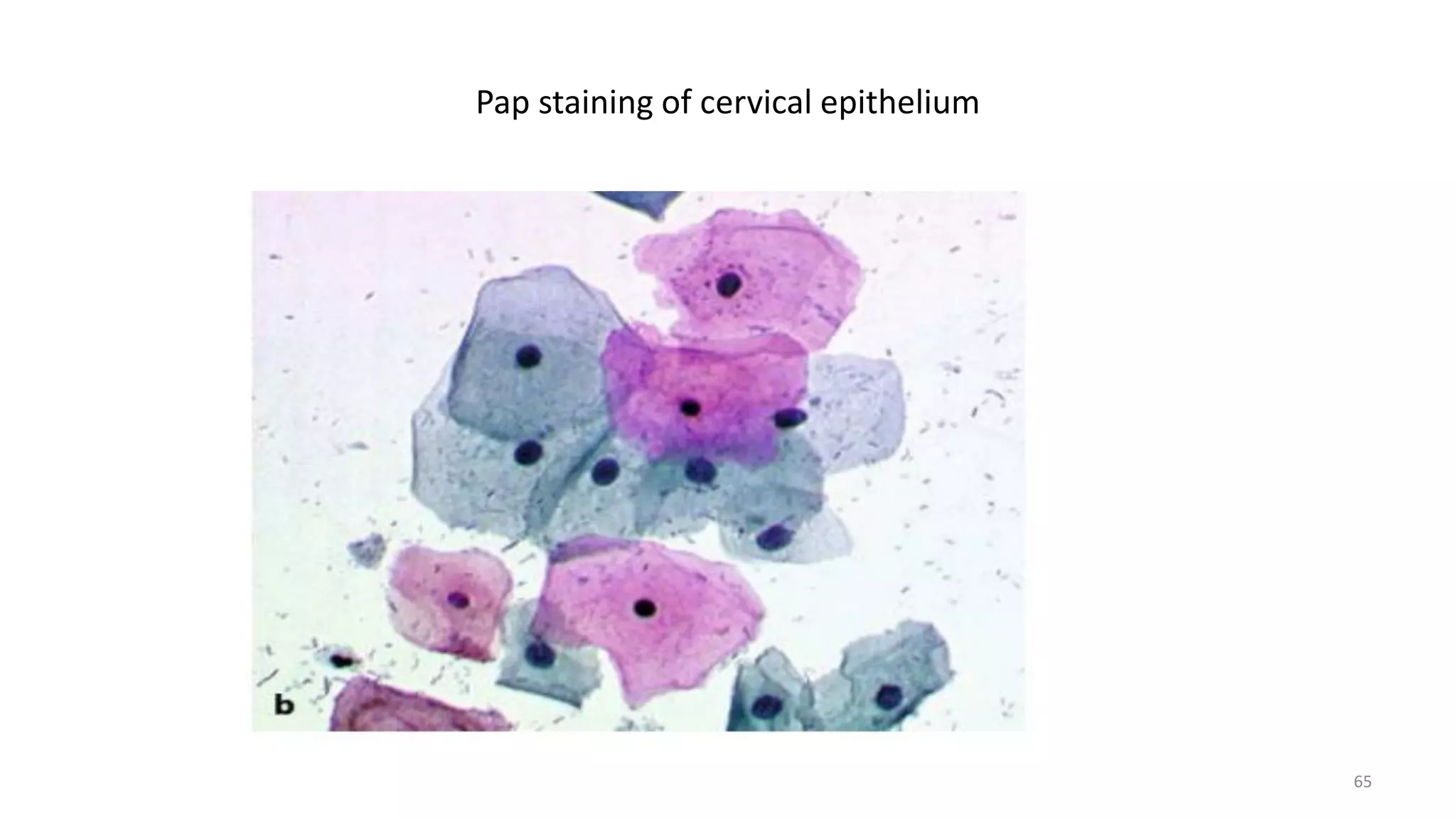 Pap staining of cervical epithelium
65
 