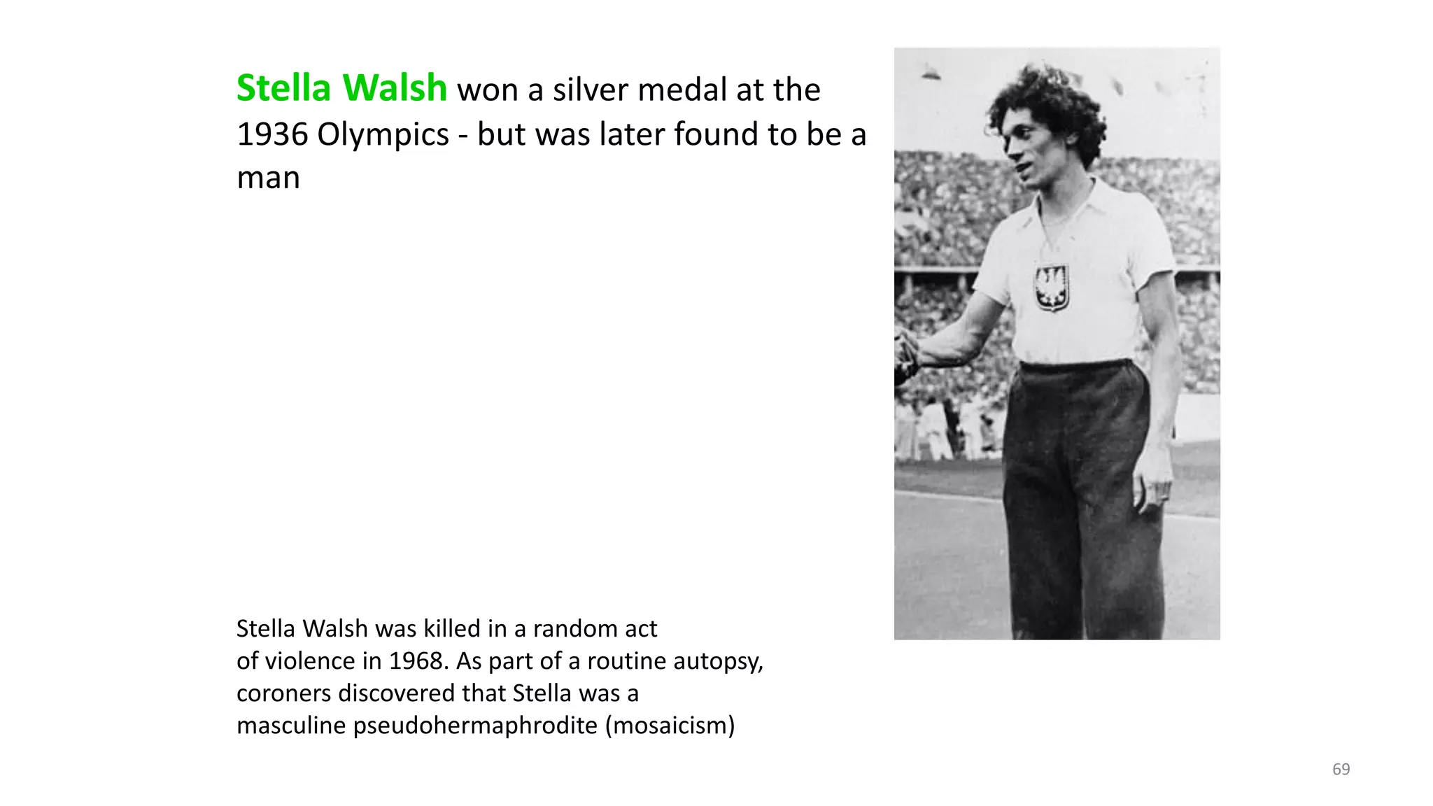 Stella Walsh won a silver medal at the
1936 Olympics - but was later found to be a
man
Stella Walsh was killed in a random act
of violence in 1968. As part of a routine autopsy,
coroners discovered that Stella was a
masculine pseudohermaphrodite (mosaicism)
69
 