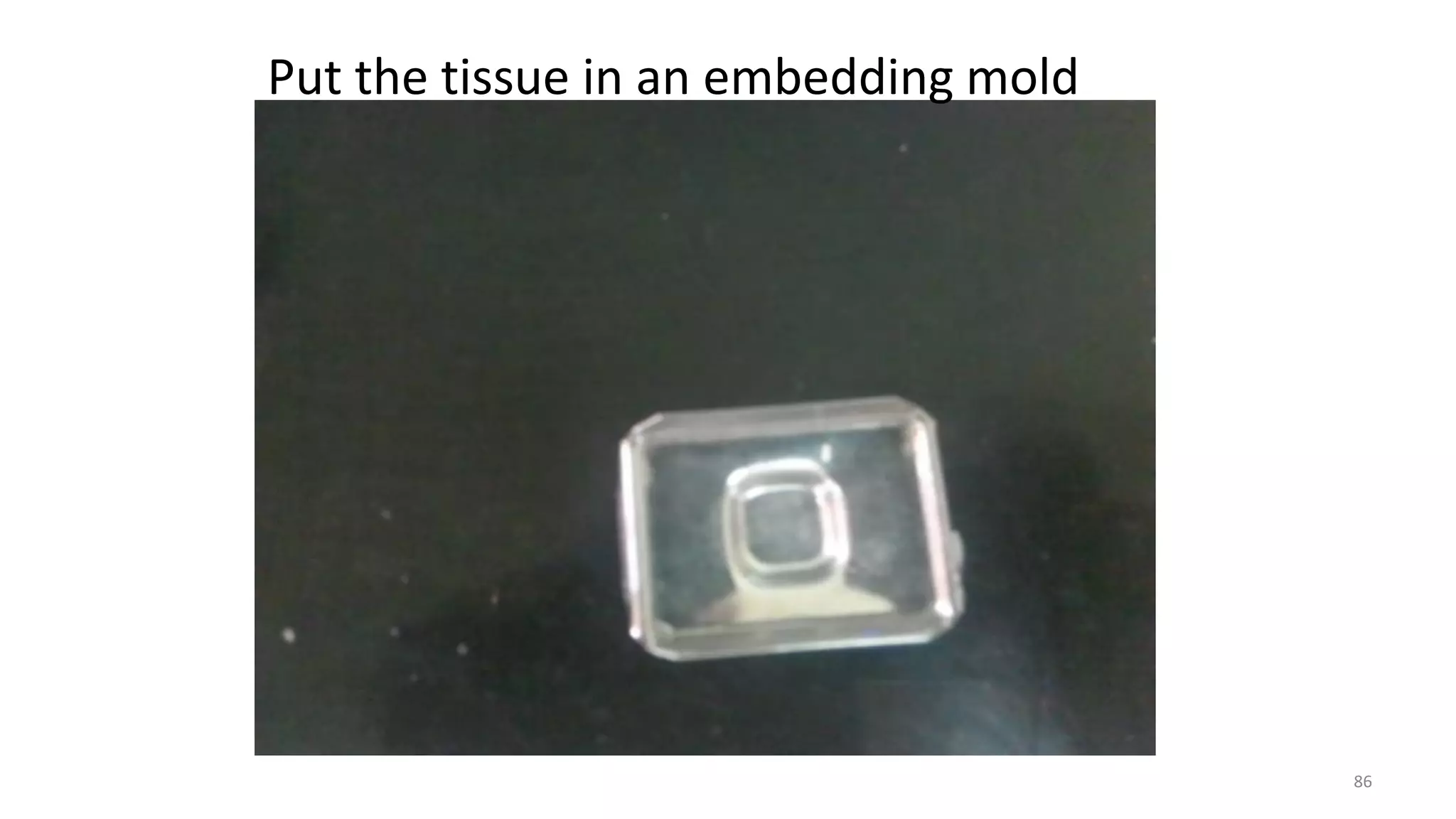 Put the tissue in an embedding mold
86
 