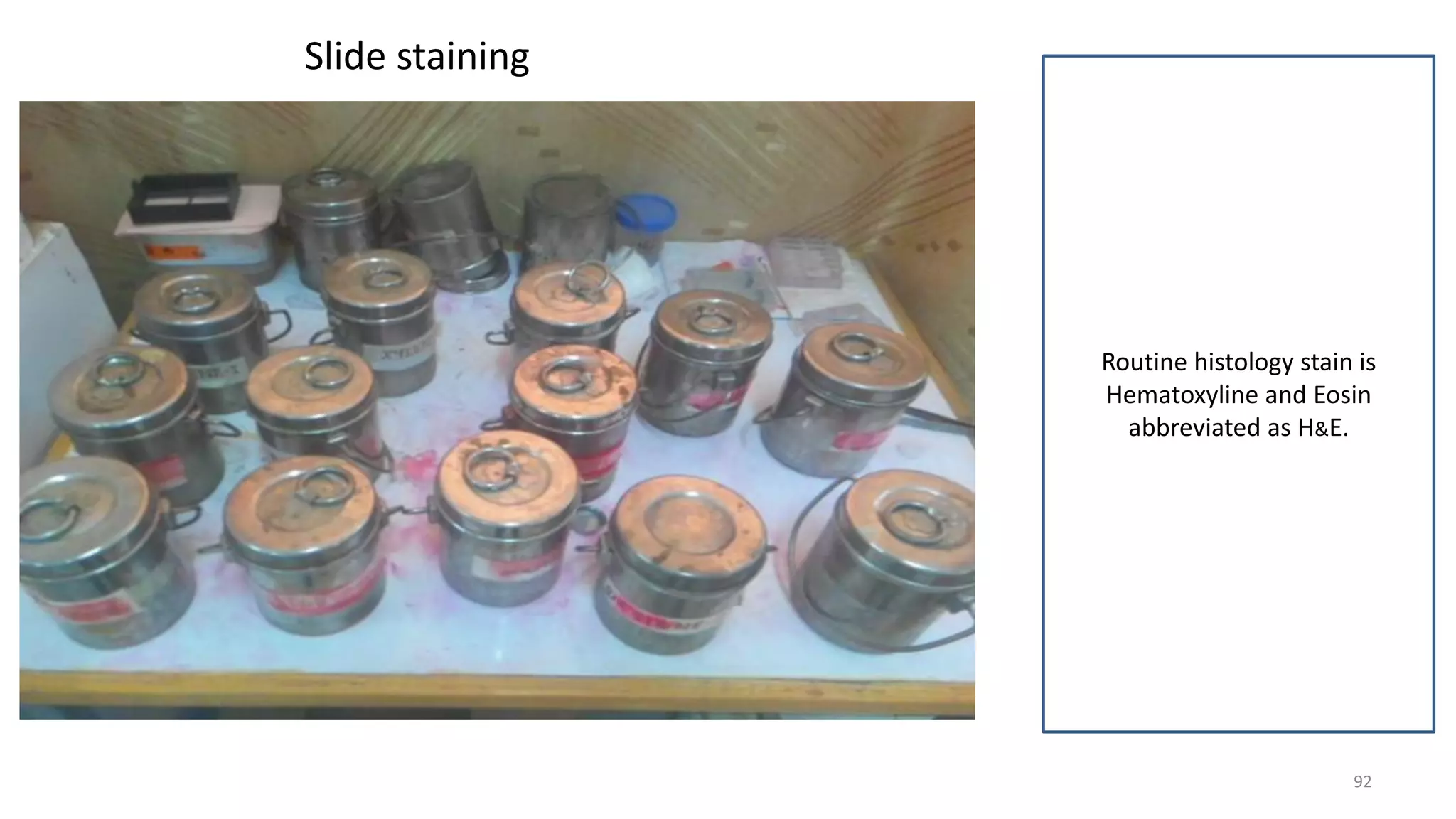 Slide staining
92
Routine histology stain is
Hematoxyline and Eosin
abbreviated as H&E.
 