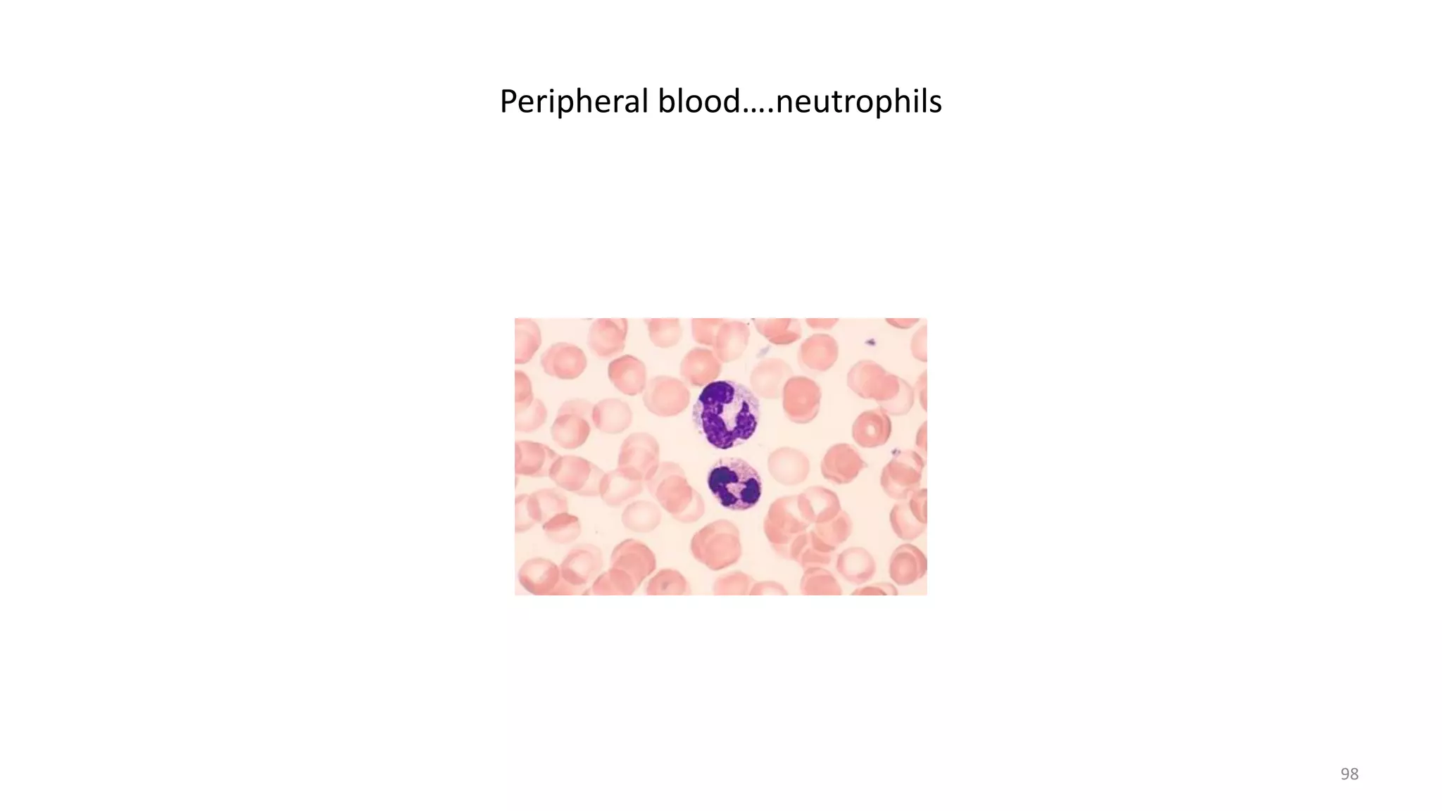 Peripheral blood….neutrophils
98
 