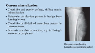 Radiological Approach To Bone Tumours | PPTX